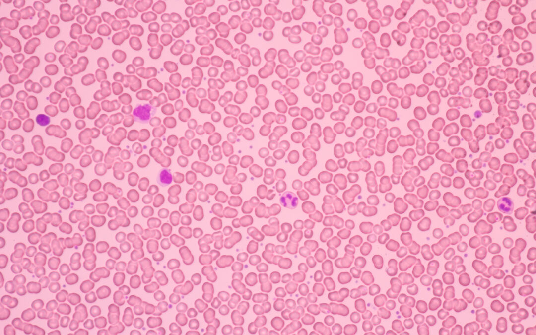 Providing immunocompetence to human microtissue bladder models